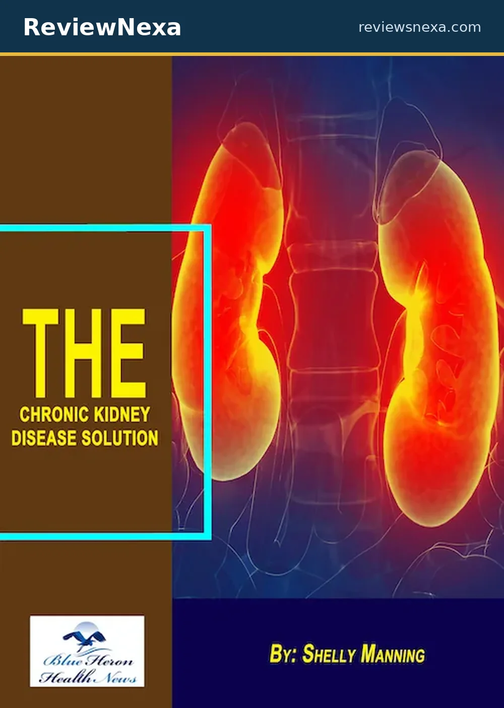 Chronic Kidney Disease Solution e-book — official product photo